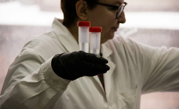 Масштабная волна инфекций: как эпидемия изменила генофонд человечества — что рассказала древняя ДНК Масштабная волна инфекций: как эпидемия изменила генофонд человечества — что рассказала древняя ДНК